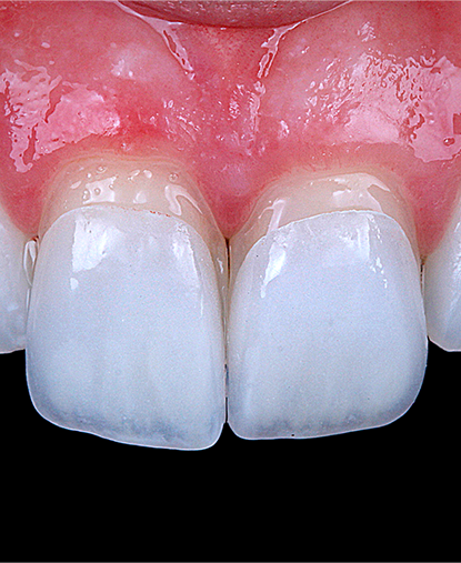 Digital Smile Design