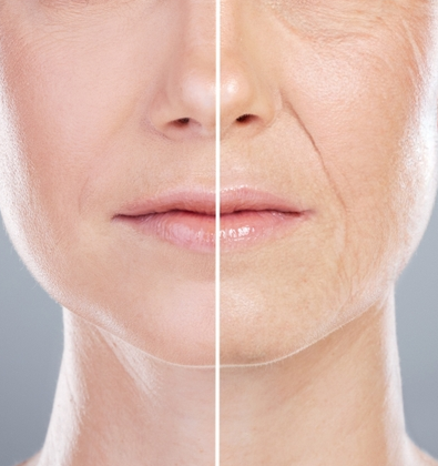 Anti-Ageing