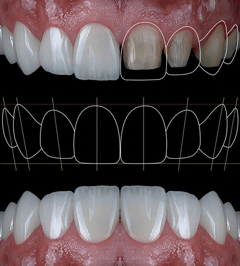 computer-digital-smile-design-treatment-600nw-2567046005